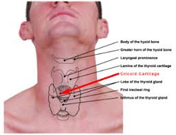 Cricopharyngeal spasm - symptoms & complications