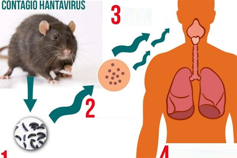 treatment for hantavirus