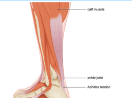 Achilles tendon home remedy