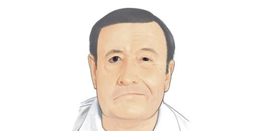 bell’s palsy treatment