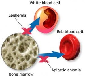 Bone marrow Home Remedy