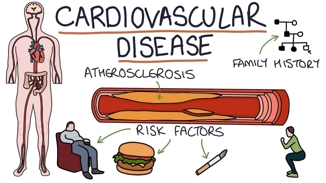 Cardiovascular Disease - Symptoms, Causes,types & Risk Factors