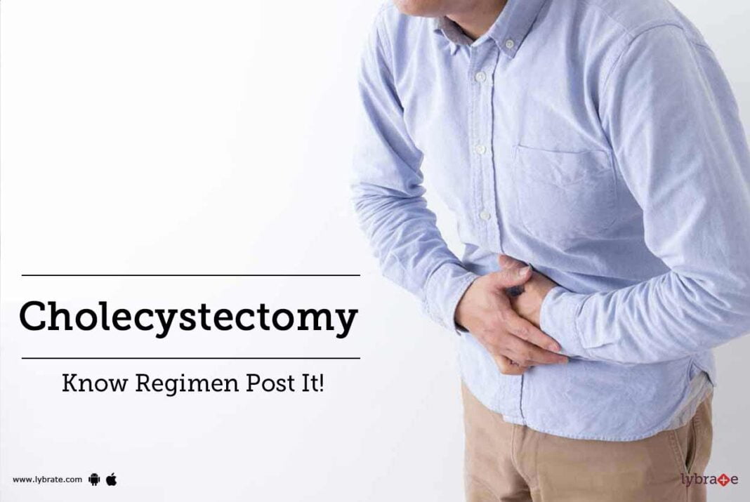 Cholecystectomy Cholecystectomy