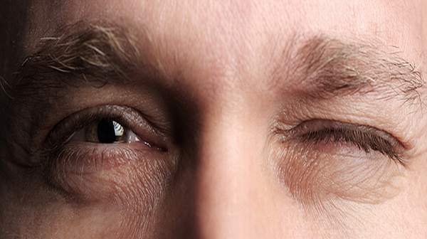 Eye twitching home remedy and natural treatments