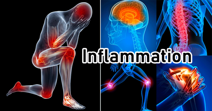 inflammation