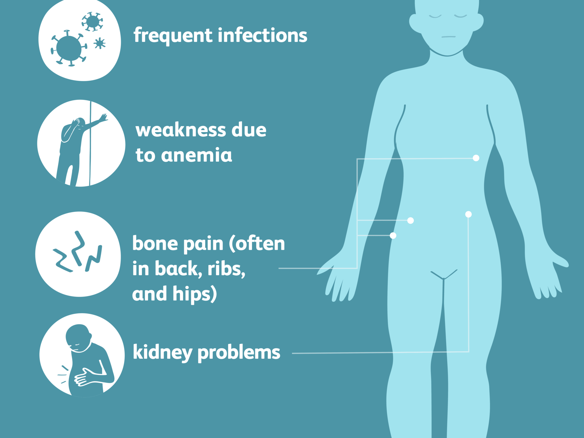 Multiple Myeloma -Symptoms, Causes, Risk Factors & Complications