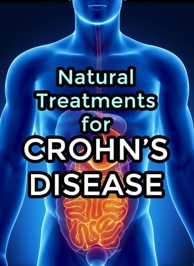Natural cures for Crohn's disease