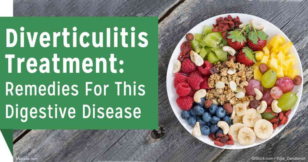 Natural Treatment And Effective Home Remedies For Diverticulitis