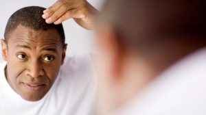 Natural cures for hair loss