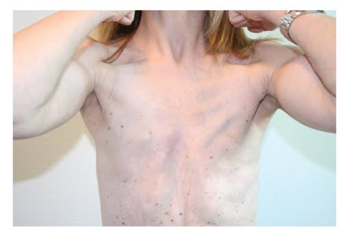 Natural cures for thin skin