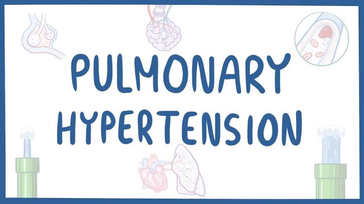 Pulmonary Hypertension Symptoms