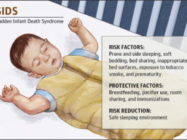 Prevent SIDS