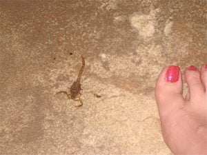 Scorpion bite Symptoms and Causes