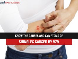 Shingles causes symptoms