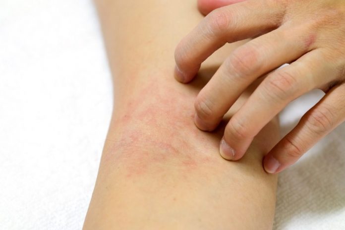 Skin cancer Symptoms and Causes