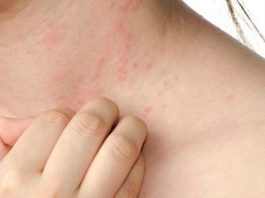 Itchy skin causes symptoms