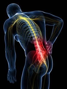 Slipped disc