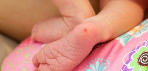 Symptoms of Sickle cell disease cause