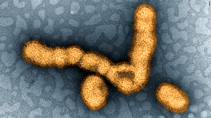 Virus H1N1 Causes and Symptoms