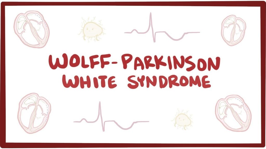 Wolff-Parkinson-White syndrome