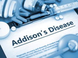 addisons disease