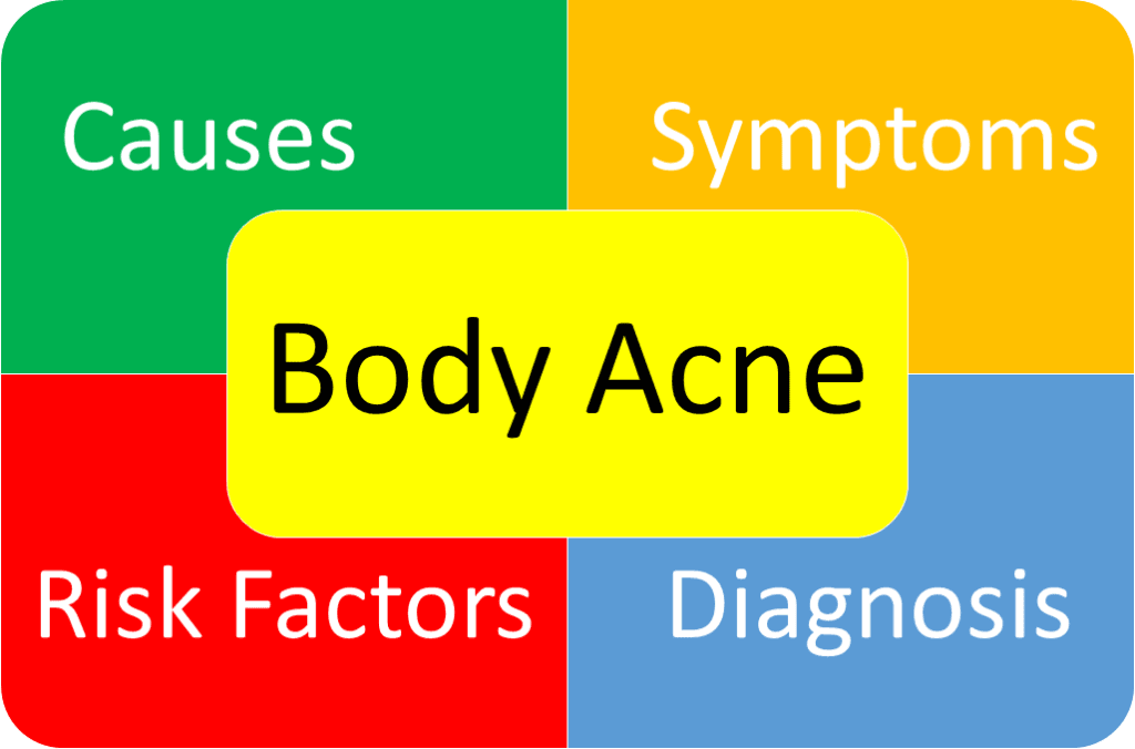 Body Acne Types, Symptoms, Causes And Other Risk Factors