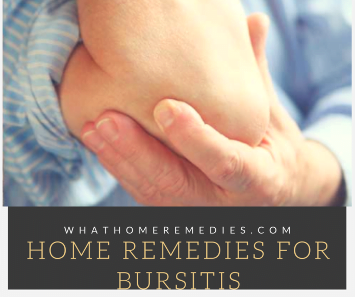 bursitis home remedy