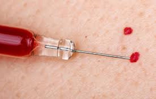 cherry angiomas itchy