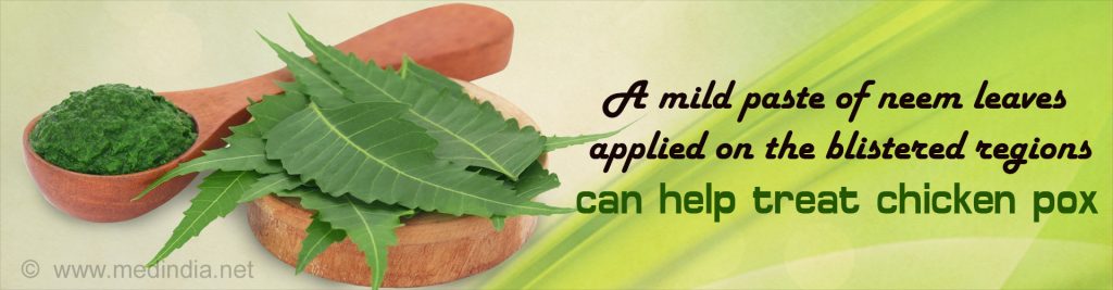chickenpox home remedy treatment