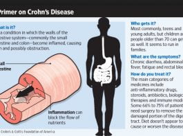 crohns disease symptoms causes