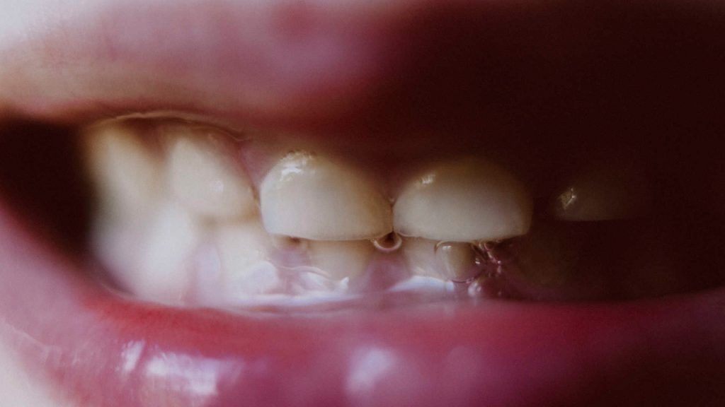 Natural Treatments For Excessive Saliva Mint, Water, Ginger And Yoghurt