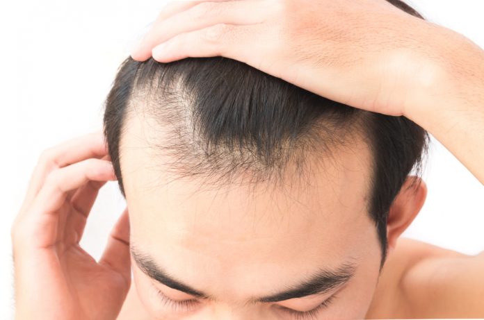 Natural cures for hair loss