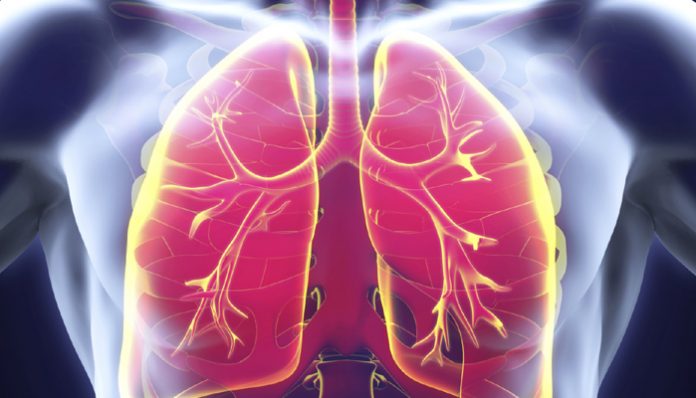 Natural cures for tuberculosis