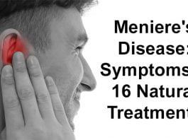 does meniere's disease go away