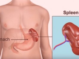 enlarged spleen and liver