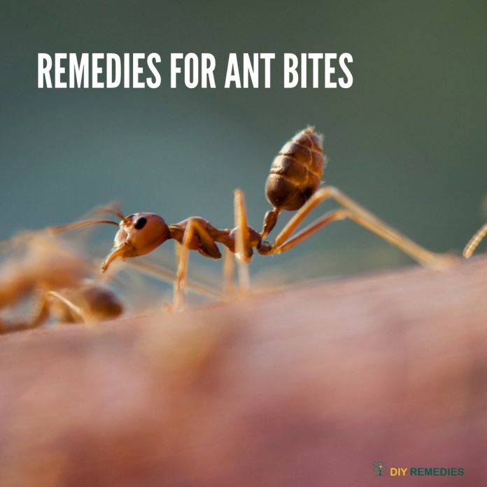 treat fire ant bites