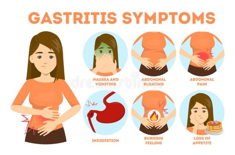 Gastritis Common Symptoms, Causes & Some Risk Factors