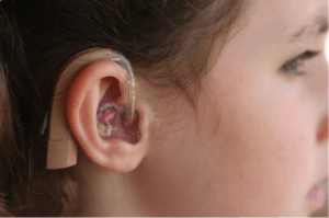 hearing impairment treatment
