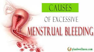 heavy menstrual bleeding