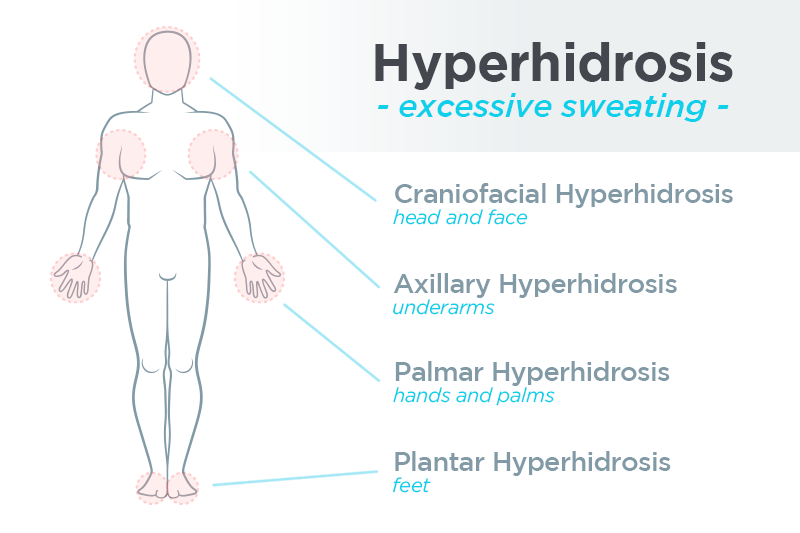 how i cured my hyperhidrosis