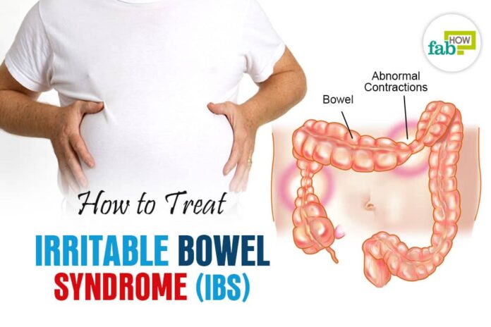 how to treat irritable bowel syndrome
