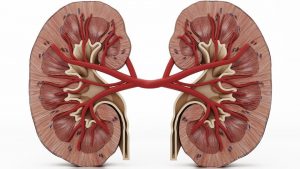 kidney disease