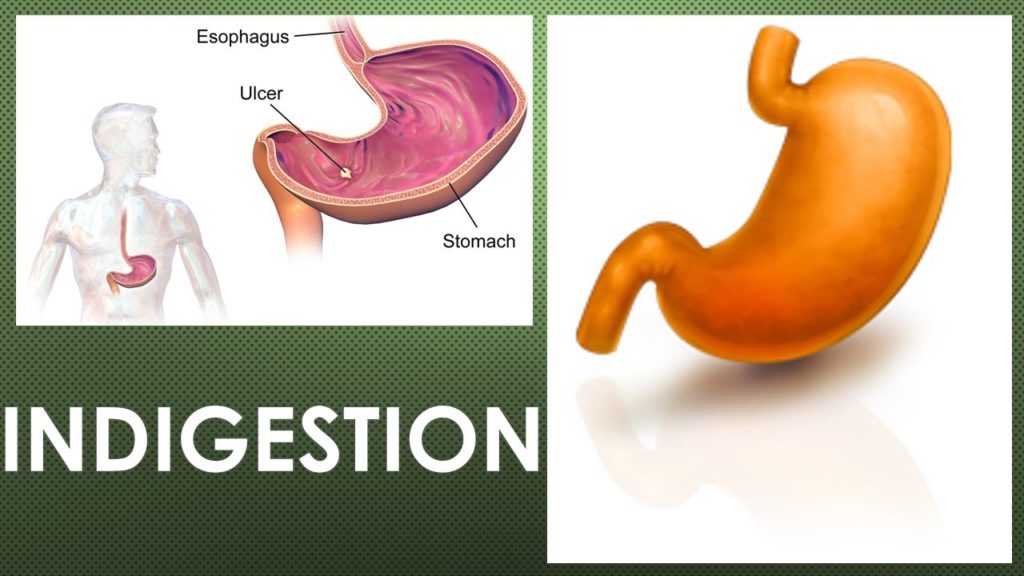 indigestion symptoms