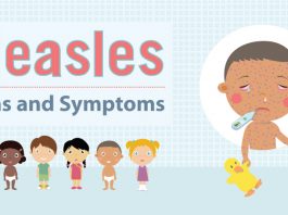 measles symptoms causes