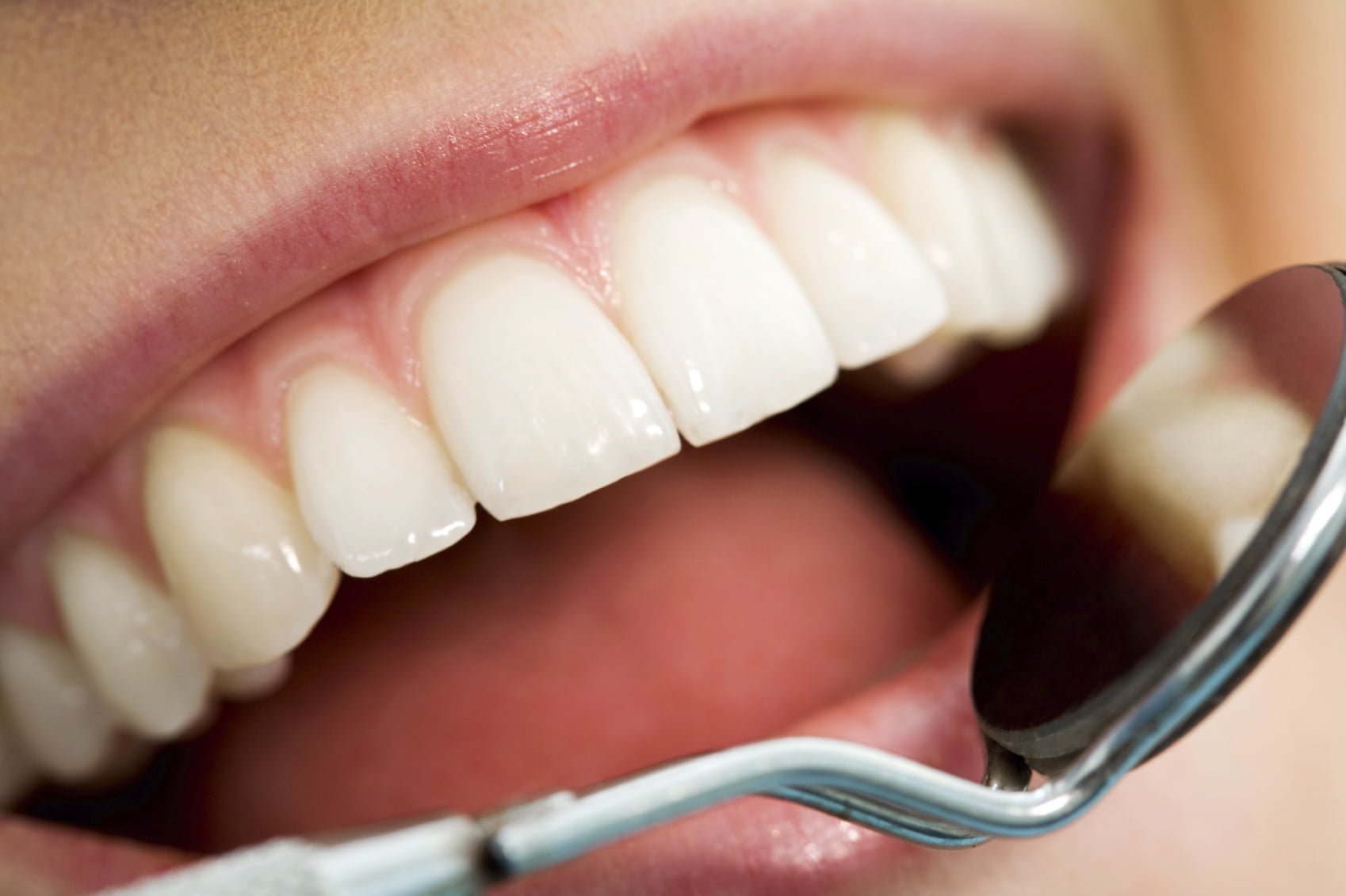 dental health, oral health