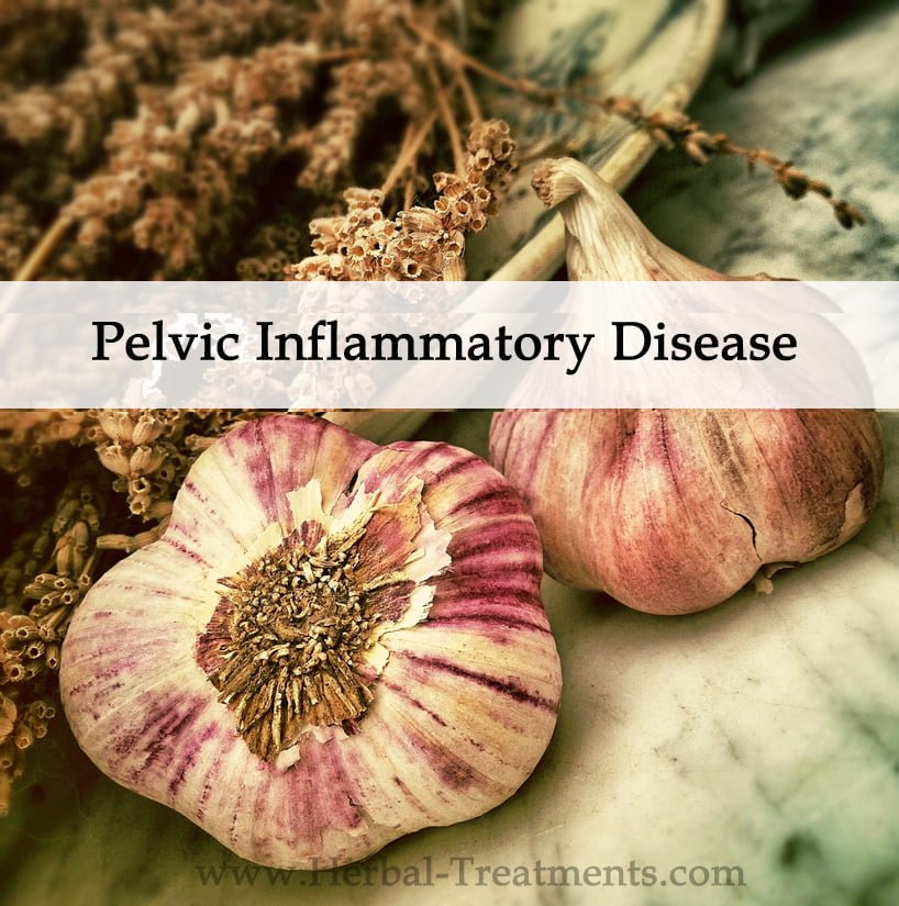 Pid natural remedies for Pelvic Inflammatory