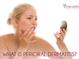 perioral dermatitis causes symptoms