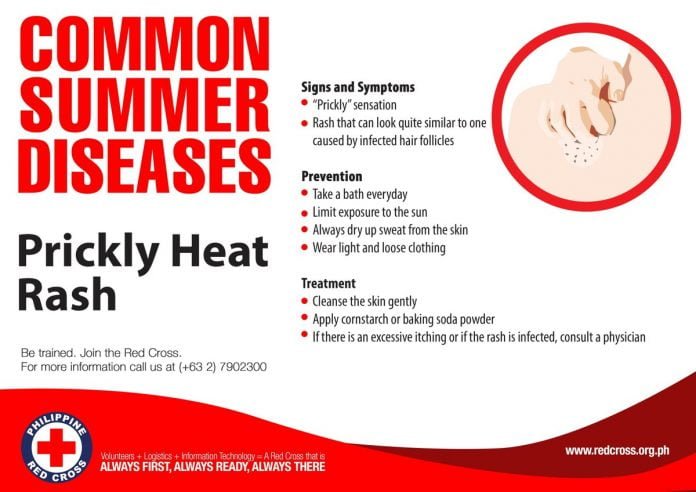 prickly heat symptoms causes