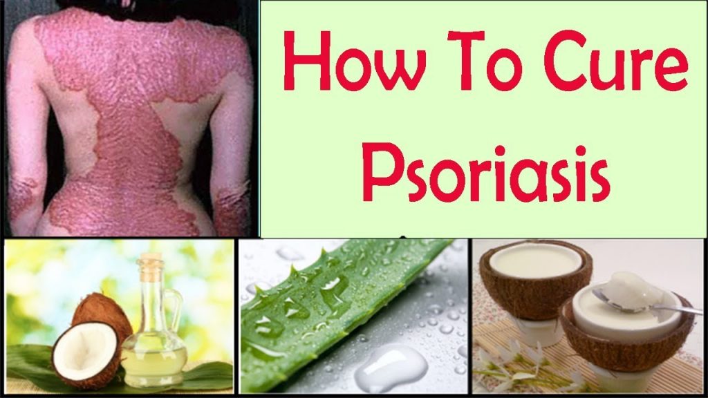 psoriasis treatment diet