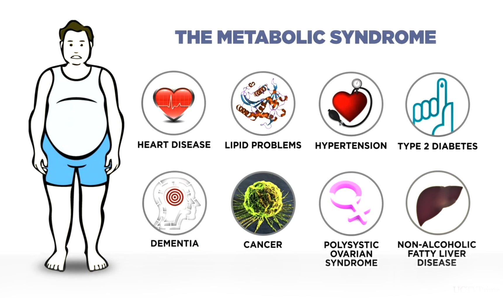 Metabolic Syndrome, Metabolic Syndrome In 2020